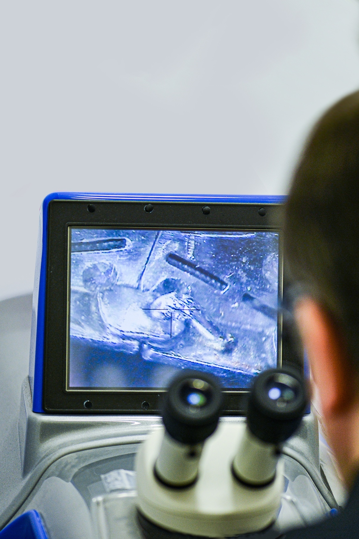 sudura laser reparatii bijuterii urgente bucuresti